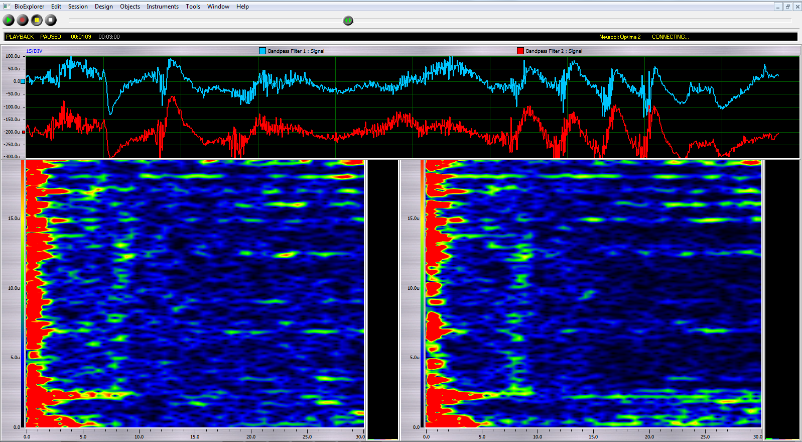 Ejemplo de análisis tiempo-frecuencia de un registro EEG